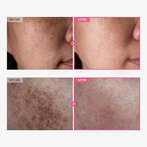 Arbutin + TXA Brightening Cream